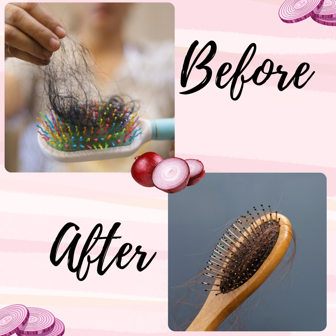 Before and after Onion Hair oil 